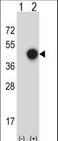 XPA Antibody - Western blot of XPA (arrow) using rabbit polyclonal XPA Antibody. 293 cell lysates (2 ug/lane) either nontransfected (Lane 1) or transiently transfected (Lane 2) with the XPA gene.