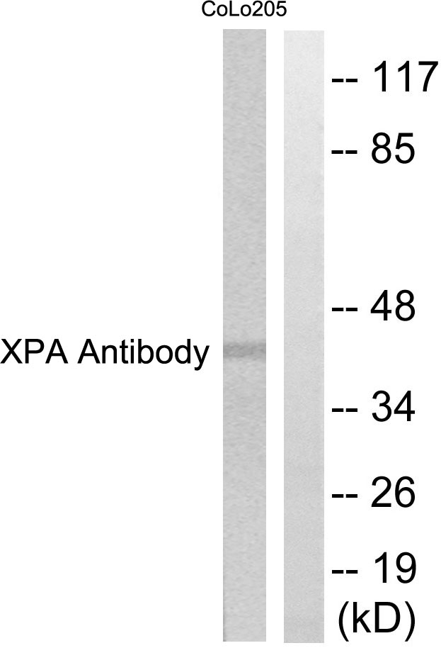 XPA Antibody - Western blot analysis of lysates from COLO205 cells, using XPA Antibody. The lane on the right is blocked with the synthesized peptide.