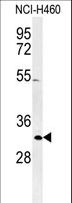 XPA Antibody - Western blot of XPA Antibody in NCI-H460 cell line lysates (35 ug/lane). XPA (arrow) was detected using the purified antibody.