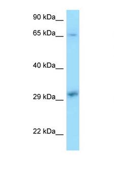 XPA Antibody - XPA antibody Western blot of 8226 Cell lysate. Antibody concentration 1 ug/ml.  This image was taken for the unconjugated form of this product. Other forms have not been tested.