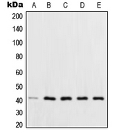 XPA Antibody - Western blot analysis of XPA expression in HCT116 (A); HeLa (B); HepG2 (C); MCF7 (D); NIH3T3 (E) whole cell lysates.