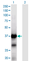 XPA Antibody - Western Blot analysis of XPA expression in transfected 293T cell line by XPA monoclonal antibody (M01), clone 2E4.Lane 1: XPA transfected lysate (Predicted MW: 31.4 KDa).Lane 2: Non-transfected lysate.