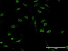 XPA Antibody - Immunofluorescence of monoclonal antibody to XPA on HeLa cell . [antibody concentration 10 ug/ml]