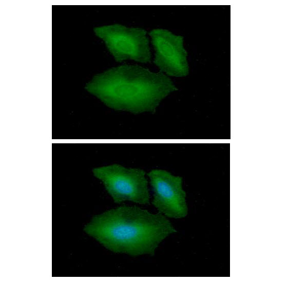 XPA Antibody - ICC/IF analysis of XPA in HaLa cells. The cell was stained with XPA antibody (1:100).The secondary antibody (green) was used Alexa Fluor 488. DAPI was stained the cell nucleus (blue).