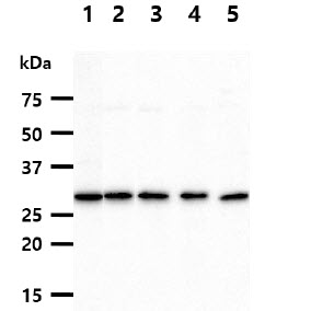XPA Antibody - The cell lysates (40ug) were resolved by SDS-PAGE, transferred to PVDF membrane and probed with anti-human XPA antibody (1:1000). Proteins were visualized using a goat anti-mouse secondary antibody conjugated to HRP and an ECL detection system. Lane 1.: SW480 cell lysate Lane 2.: K562 cell lysate Lane 3.: MCF7 cell lysate Lane 4.: LNCaP cell lysate Lane 5.: Raji cell lysate