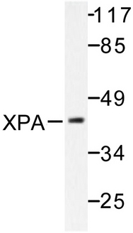 XPA Antibody - Western blot of XPA (H244) pAb in extracts from COLO205 cells.