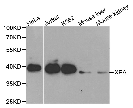 XPA Antibody - Western blot analysis of extracts of various cell lines, using XPA antibody at 1:1000 dilution. The secondary antibody used was an HRP Goat Anti-Rabbit IgG (H+L) at 1:10000 dilution. Lysates were loaded 25ug per lane and 3% nonfat dry milk in TBST was used for blocking.