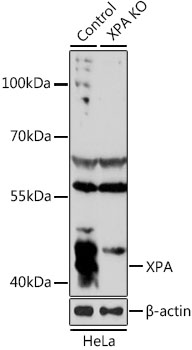 XPA Antibody - Western blot analysis of extracts from normal (control) and XPA knockout (KO) HeLa cells, using XPA antibodyat 1:1000 dilution. The secondary antibody used was an HRP Goat Anti-Rabbit IgG (H+L) at 1:10000 dilution. Lysates were loaded 25ug per lane and 3% nonfat dry milk in TBST was used for blocking. An ECL Kit was used for detection and the exposure time was 15s.