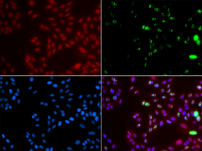 XPA Antibody - Immunofluorescence analysis of GFP-RNF168 transgenic U2OS cells using XPA antibody. Green:GFP-RNF168 fusion protein expression for DNA damage marker.Blue: DAPI for nuclear staining.RNF168(GFP) can be used to mark cells damaged by UV-A laser for they always gather around DNA damage region.