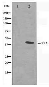 XPA Antibody - Western blot of COLO205 cell lysate using XPA Antibody