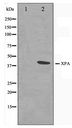XPA Antibody - Western blot of COLO205 cell lysate using XPA Antibody