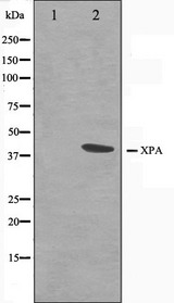 XPA Antibody - Western blot analysis on COLO205 cell lysates using XPA antibody. The lane on the left is treated with the antigen-specific peptide.