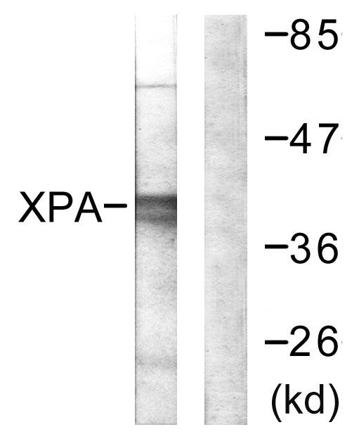 XPA Antibody - Western blot analysis of extracts from COLO205 cells, using XPA antibody.