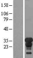 XPA Protein - Western validation with an anti-DDK antibody * L: Control HEK293 lysate R: Over-expression lysate