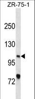 XPC Antibody - XPC Antibody western blot of ZR-75-1 cell line lysates (35 ug/lane). The XPC antibody detected the XPC protein (arrow).