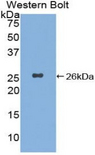 XPC Antibody - Western blot of recombinant XPC.  This image was taken for the unconjugated form of this product. Other forms have not been tested.