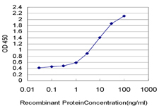 XPC Antibody - Detection limit for recombinant GST tagged XPC is approximately 0.03 ng/ml as a capture antibody.