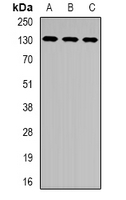 XPC Antibody - Western blot analysis of XPC expression in HeLa (A); HEK293T (B); Jurkat (C) whole cell lysates.