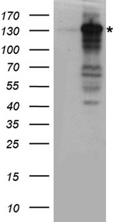 XPC Antibody - HEK293T cells were transfected with the pCMV6-ENTRY control. (Left lane) or pCMV6-ENTRY XPC. (Right lane) cDNA for 48 hrs and lysed. Equivalent amounts of cell lysates. (5 ug per lane) were separated by SDS-PAGE and immunoblotted with anti-XPC rabbit polyclonal antibody.