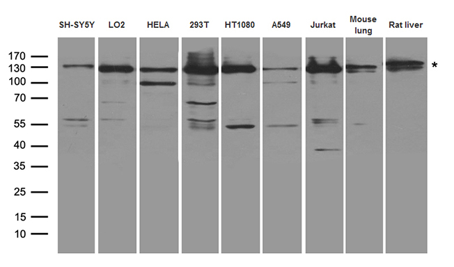 XPC Antibody - Western blot analysis of extracts. (35ug) from different cell lines and tissues by using anti-XPC rabbit polyclonal antibody.