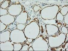 XPNPEP1 / Aminopeptidase P Antibody - Immunohistochemical staining of paraffin-embedded Human thyroid tissue using anti-XPNPEP1 mouse monoclonal antibody. (Dilution 1:50).