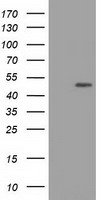 XPNPEP1 / Aminopeptidase P Antibody - HEK293T cells were transfected with the pCMV6-ENTRY control (Left lane) or pCMV6-ENTRY XPNPEP1 (Right lane) cDNA for 48 hrs and lysed. Equivalent amounts of cell lysates (5 ug per lane) were separated by SDS-PAGE and immunoblotted with anti-XPNPEP1.