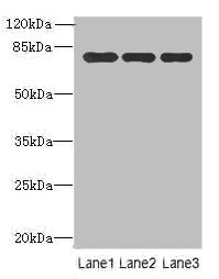 XPNPEP1 / Aminopeptidase P Antibody - Western blot All lanes: Xaa-Pro aminopeptidase 1 antibody at 8µg/ml Lane 1: Mouse small intestine tissue Lane 2: Mouse stomach tissue Lane 3: Mouse kidney tissue Secondary Goat polyclonal to rabbit IgG at 1/10000 dilution Predicted band size: 70, 68, 75, 73 kDa Observed band size: 70 kDa