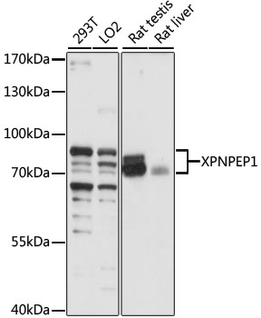 XPNPEP1 / Aminopeptidase P Antibody - Western blot analysis of extracts of various cell lines, using XPNPEP1 antibody at 1:1000 dilution. The secondary antibody used was an HRP Goat Anti-Rabbit IgG (H+L) at 1:10000 dilution. Lysates were loaded 25ug per lane and 3% nonfat dry milk in TBST was used for blocking. An ECL Kit was used for detection and the exposure time was 5s.