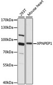 XPNPEP1 / Aminopeptidase P Antibody - Western blot analysis of extracts of various cell lines, using XPNPEP1 antibody at 1:1000 dilution. The secondary antibody used was an HRP Goat Anti-Rabbit IgG (H+L) at 1:10000 dilution. Lysates were loaded 25ug per lane and 3% nonfat dry milk in TBST was used for blocking. An ECL Kit was used for detection and the exposure time was 5s.