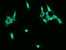 XPNPEP1 / Aminopeptidase P Antibody - Immunofluorescence staining of XPNPEP1 in A431 cells. Cells were fixed with 4% PFA, permeabilzed with 0.1% Triton X-100 in PBS, blocked with 10% serum, and incubated with rabbit anti-Human XPNPEP1 polyclonal antibody (dilution ratio 1:200) at 4°C overnight. Then cells were stained with the Alexa Fluor 488-conjugated Goat Anti-rabbit IgG secondary antibody (green) and counterstained with DAPI (blue). Positive staining was localized to Cytoplasm.