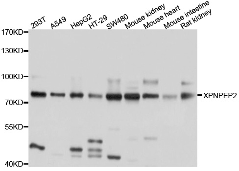 XPNPEP2 Antibody - Western blot analysis of extracts of various cell lines, using XPNPEP2 antibody at 1:1000 dilution. The secondary antibody used was an HRP Goat Anti-Rabbit IgG (H+L) at 1:10000 dilution. Lysates were loaded 25ug per lane and 3% nonfat dry milk in TBST was used for blocking. An ECL Kit was used for detection and the exposure time was 1s.