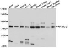 XPNPEP2 Antibody - Western blot analysis of extracts of various cell lines, using XPNPEP2 antibody at 1:1000 dilution. The secondary antibody used was an HRP Goat Anti-Rabbit IgG (H+L) at 1:10000 dilution. Lysates were loaded 25ug per lane and 3% nonfat dry milk in TBST was used for blocking. An ECL Kit was used for detection and the exposure time was 1s.