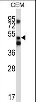 XPNPEP3 Antibody - XPNPEP3 Antibody western blot of CEM cell line lysates (35 ug/lane). The XPNPEP3 antibody detected the XPNPEP3 protein (arrow).