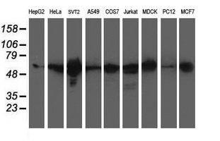 XPNPEP3 Antibody - Western blot of extracts (35ug) from 9 different cell lines by using anti-XPNPEP3 monoclonal antibody.