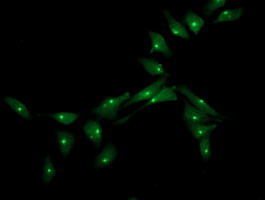XPNPEP3 Antibody - Immunofluorescent staining of HeLa cells using anti-XPNPEP3 mouse monoclonal antibody.
