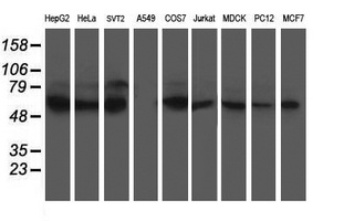XPNPEP3 Antibody - Western blot of extracts (35 ug) from 9 different cell lines by using anti-XPNPEP3 monoclonal antibody.