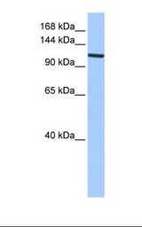 XPO1 / CRM1 Antibody - Fetal heart cell lysate. Antibody concentration: 0.5 ug/ml. Gel concentration: 6%-18%.  This image was taken for the unconjugated form of this product. Other forms have not been tested.