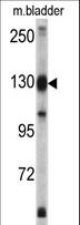 XPO1 / CRM1 Antibody - Western blot of XPO1 antibody in mouse bladder tissue lysates (35 ug/lane). XPO1 (arrow) was detected using the purified antibody.