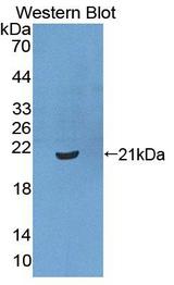 XPO1 / CRM1 Antibody - Western blot of XPO1 / CRM1 antibody.