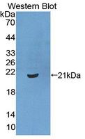 XPO1 / CRM1 Antibody - Western blot of XPO1 / CRM1 antibody.