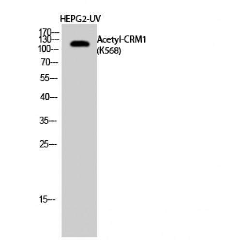 XPO1 / CRM1 Antibody - Western blot of Acetyl-CRM1 (K568) antibody
