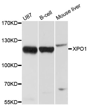 XPO1 / CRM1 Antibody - Western blot analysis of extracts of various cell lines, using XPO1 antibody at 1:1000 dilution. The secondary antibody used was an HRP Goat Anti-Rabbit IgG (H+L) at 1:10000 dilution. Lysates were loaded 25ug per lane and 3% nonfat dry milk in TBST was used for blocking. An ECL Kit was used for detection and the exposure time was 1s.
