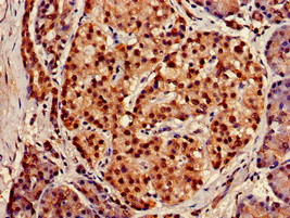XPO1 / CRM1 Antibody - Immunohistochemistry of paraffin-embedded human pancreatic tissue using XPO1 Antibody at dilution of 1:100