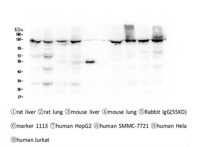 XPO1 / CRM1 Antibody - Western blot analysis of CRM1 using anti-CRM1 antibody. Electrophoresis was performed on a 5-20% SDS-PAGE gel at 70V (Stacking gel) / 90V (Resolving gel) for 2-3 hours. The sample well of each lane was loaded with 50ug of sample under reducing conditions. Lane 1: rat liver tissue lysates, Lane 2: rat lung tissue lysates, Lane 3: mouse liver tissue lysates, Lane 4: mouse lung tissue lysates, Lane 5: Rabbit IgG, Lane 6: Marker 1113, Lane 7: human HepG2 whole cell lysates, Lane 8: human SMMC-7721 whole cell lysates, Lane 9: human Hela whole cell lysates,Lane 10: human JURKAT whole cell lysates. After Electrophoresis, proteins were transferred to a Nitrocellulose membrane at 150mA for 50-90 minutes. Blocked the membrane with 5% Non-fat Milk/ TBS for 1.5 hour at RT. The membrane was incubated with mouse anti-CRM1 antigen affinity purified monoclonal antibody at 0.5 µg/mL overnight at 4°C, then washed with TBS-0.1% Tween 3 times with 5 minutes each and probed with a Biotin Conjugated goat anti-mouse IgG secondary antibody at a dilution of 1:10000 for 1.5 hour at RT. The signal is developed using an Enhanced Chemiluminescent detection (ECL) kit with Tanon 5200 system.