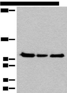 XPO1 / CRM1 Antibody - Western blot analysis of Hela K562 and HEPG2 cell lysates  using XPO1 Polyclonal Antibody at dilution of 1:200