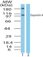 XPO4 / Exportin 4 Antibody - Western blot of Exportin-4 in Jurkat cell lysate in the 1) absence and 2) presence of immunizing peptide using antibody at 2 ug/ml.