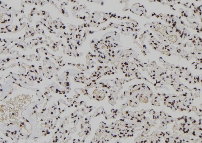 XPO4 / Exportin 4 Antibody - 1:100 staining human lung tissue by IHC-P. The sample was formaldehyde fixed and a heat mediated antigen retrieval step in citrate buffer was performed. The sample was then blocked and incubated with the antibody for 1.5 hours at 22°C. An HRP conjugated goat anti-rabbit antibody was used as the secondary.