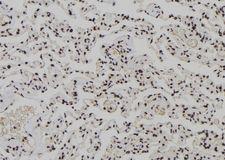 XPO4 / Exportin 4 Antibody - 1:100 staining human lung tissue by IHC-P. The sample was formaldehyde fixed and a heat mediated antigen retrieval step in citrate buffer was performed. The sample was then blocked and incubated with the antibody for 1.5 hours at 22°C. An HRP conjugated goat anti-rabbit antibody was used as the secondary.