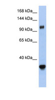 XPO5 / Exportin 5 Antibody - XPO5 / Exportin-5 antibody Western blot of Fetal Small Intestine lysate. This image was taken for the unconjugated form of this product. Other forms have not been tested.