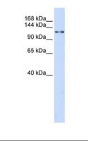 XPO5 / Exportin 5 Antibody - 293T cell lysate. Antibody concentration: 1.0 ug/ml. Gel concentration: 6-18%.  This image was taken for the unconjugated form of this product. Other forms have not been tested.